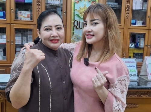 2 Pekan Pasca-Operasi di Queen Klinik Sunter, Irma Darmawangsa Makin Puas dengan Hidung Mancung ala Blaster Eropa
