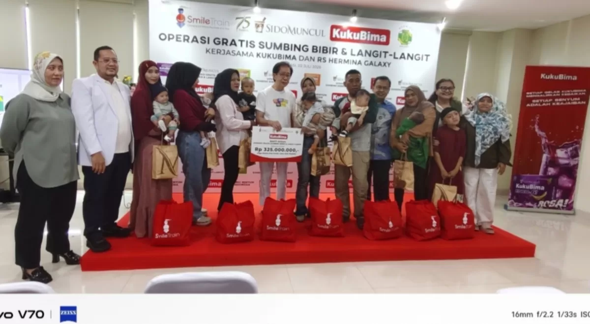 Kuku Bima dan Tolak Angin Gelar Operasi Gratis 50 Pasien Bibir Sumbing di RS Hermina Galaxy Bekasi